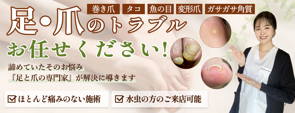 足・爪のトラブルお任せください!